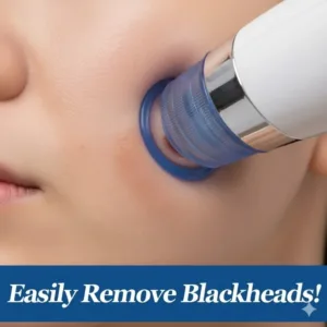 Blackhead Remover Vacuum: Pimple & Acne Suction Tool (4-in-1)